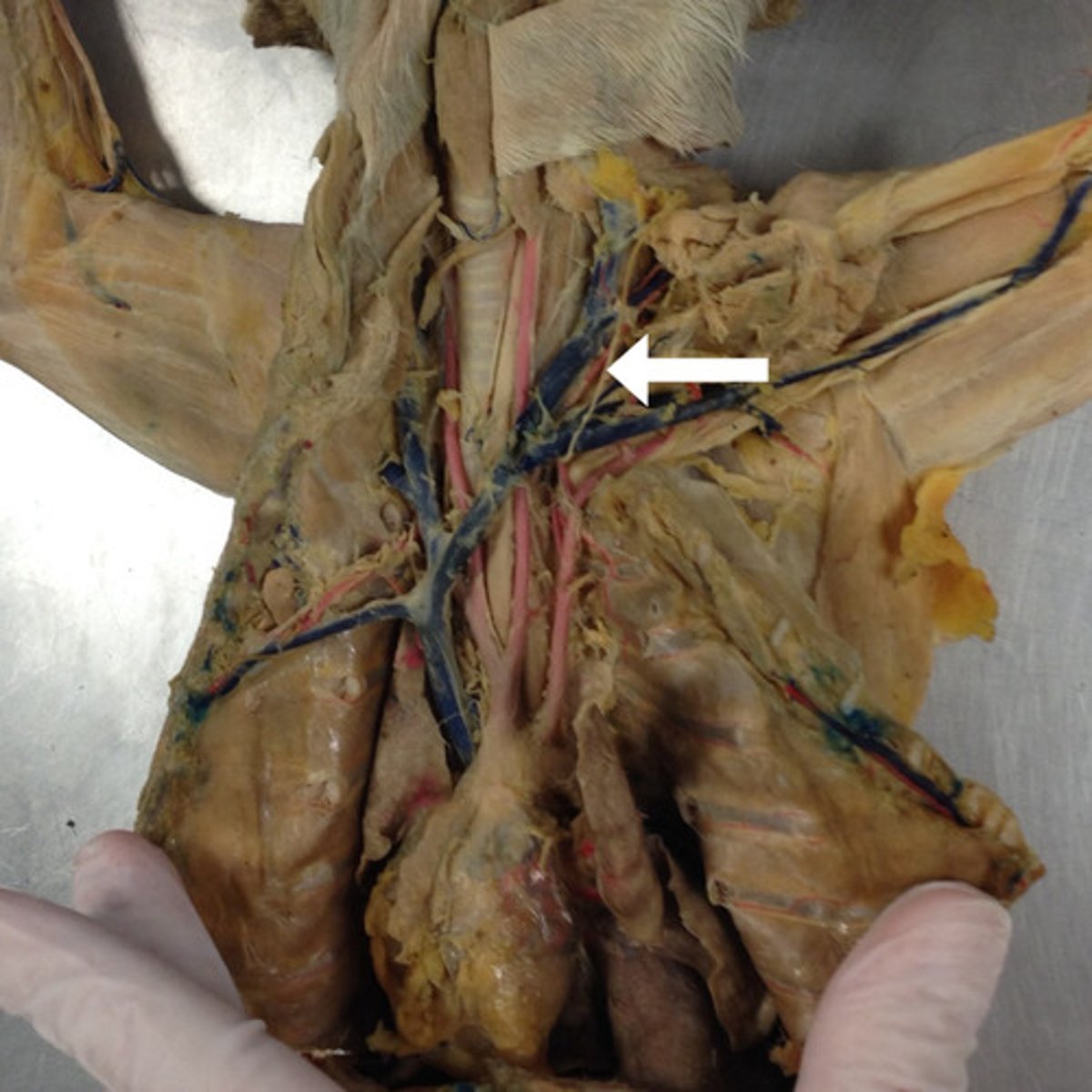 <p>branches off of thyrocervical artery</p>