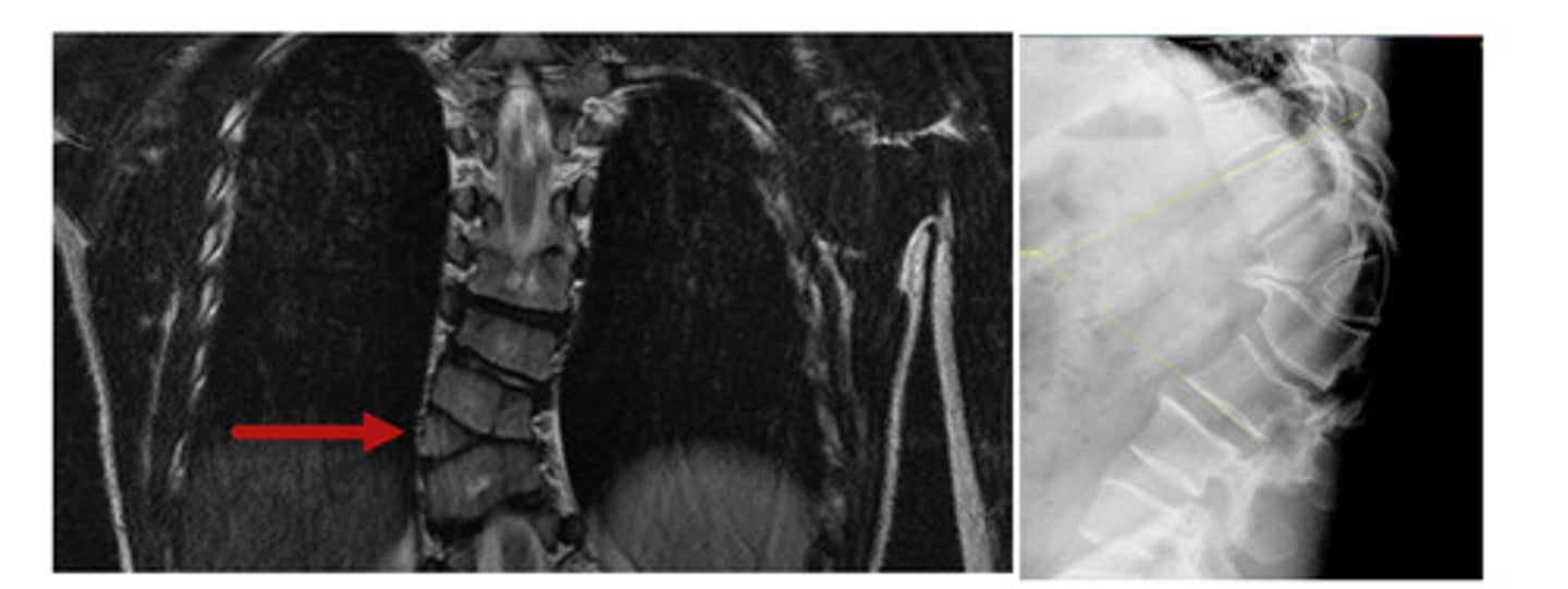 <p>What anomaly is this?</p>