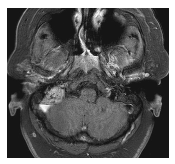 <p>What does the figure show?</p>
