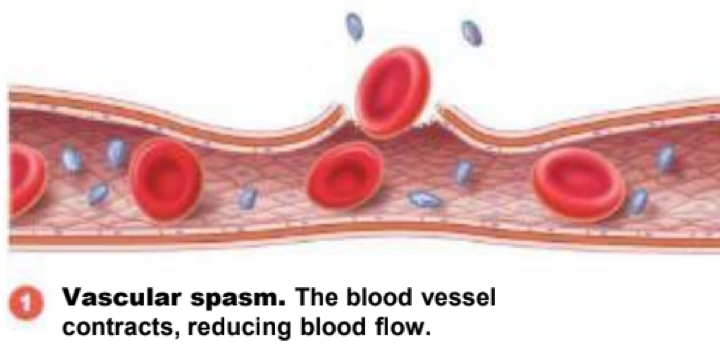 <p>vascular spasm (step 1) </p>