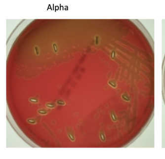 <p>is the incomplete lysis which produces a greenish zone around the colony S. pneumoniae some other normal flora also do this</p>