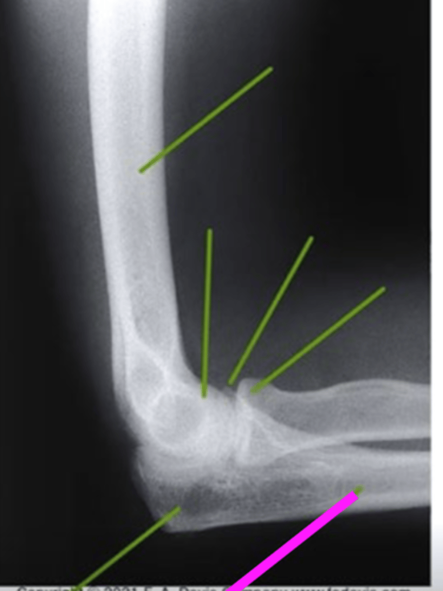 <p>what does the pink line point to?</p>