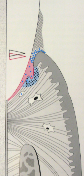 <ul><li><p>Build up of G+ aerobic bacteria</p></li><li><p>Alteration of junctional epithelium</p></li><li><p>Vasculitis, increase in crevicular fluid outflow, increase PMNs, inflammatory cell migration</p></li><li><p>Attention fibroblasts, collagen changes</p></li><li><p>Attention bone WNL</p></li></ul><p></p>