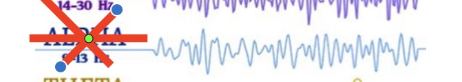 <p>What brain wave is this? Where is it present? </p>