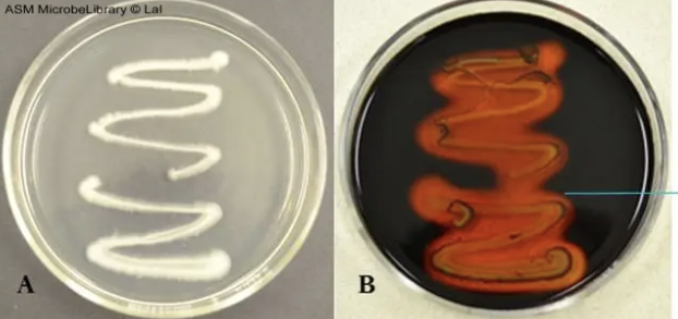 <p>Is this a positive or negative Starch hydrolysis (Starch agar)?</p>
