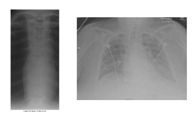 <p>What is wrong with this xray images</p>