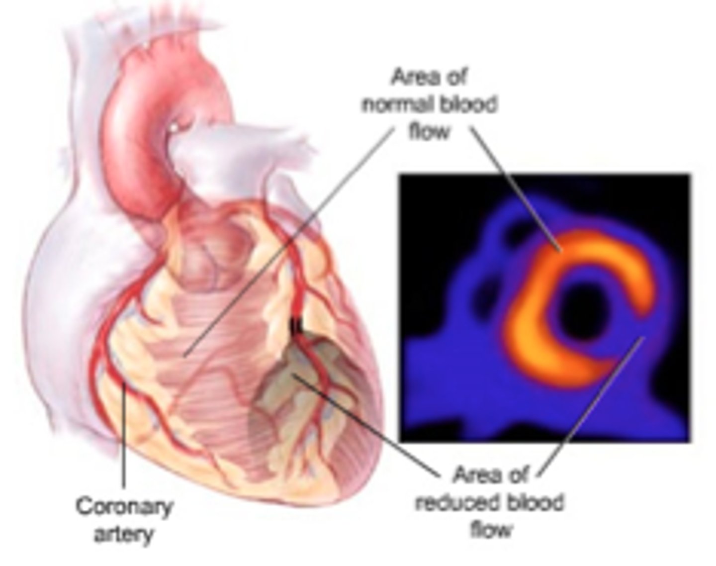 <p>Depends on selective uptake of certain compounds by different organs of the body</p><p>-Organs are 'labeled' with a radioactive substance of sufficient energy level to allow detection outside the body</p><p>-Look for areas with radiation accumulation</p>