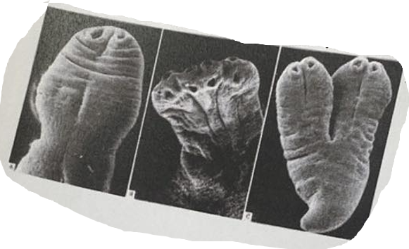 <p>What is the developmental stage in the picture? To which tape worm belongs?</p>
