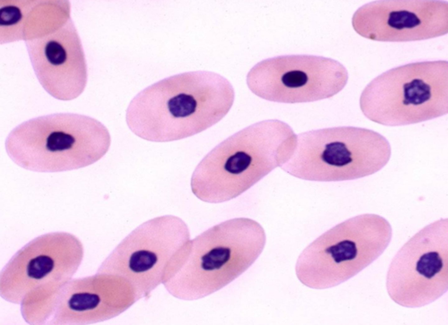 <p>exotics red blood cell</p>