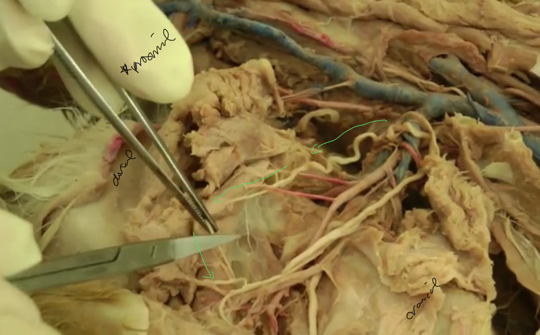 <p>what nerve is highlighted?</p>