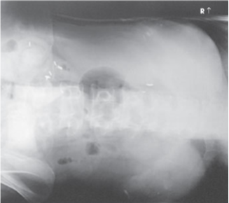 <p>What projection, position, and anatomy is this?</p>