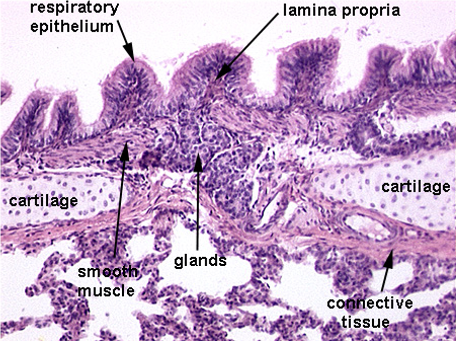 <p><strong>Bronchus</strong></p><p><em>Has cartilage. Bronchioles will not have cartilage</em></p>