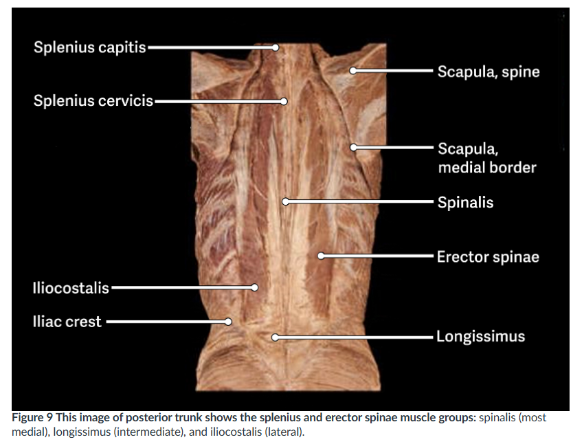 <p><span>Extend or hyperextend head; unilateral: rotate head to same side </span></p>
