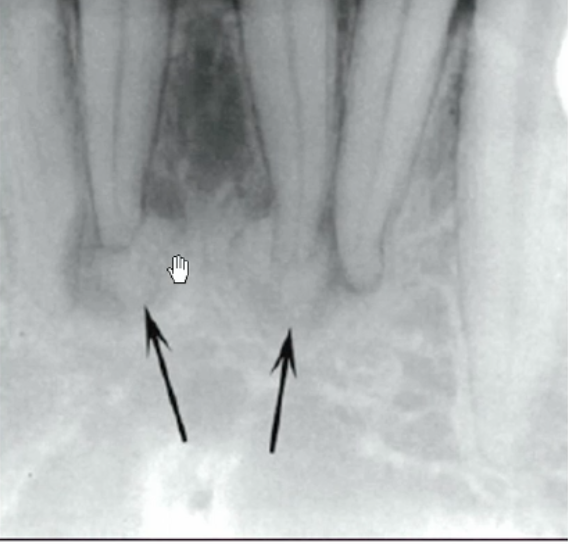 <p>how would you describe the internal structure of this lesion </p>