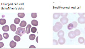 <p>What is the genus, species and stage of the image on the left?</p>