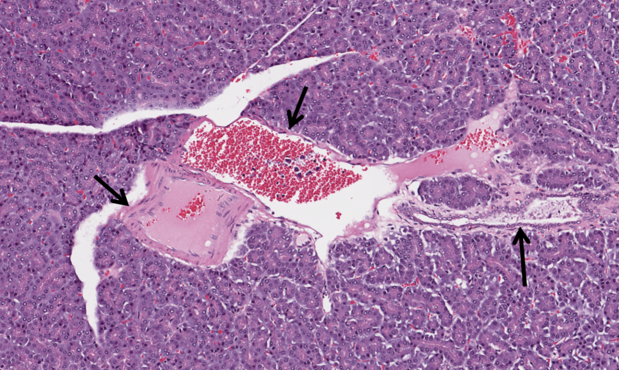 <p>what is visible in this image of a pancreas?</p>