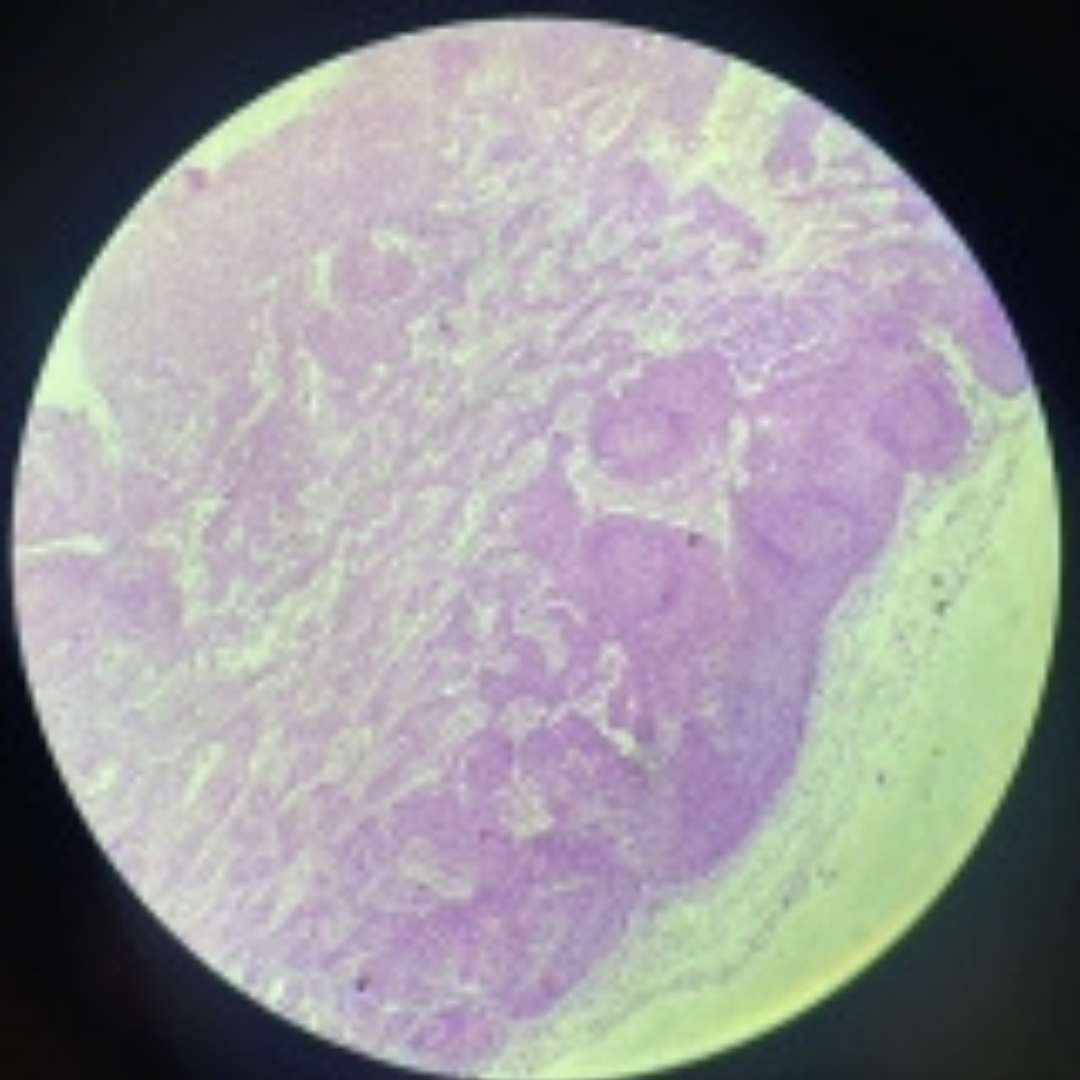 term image