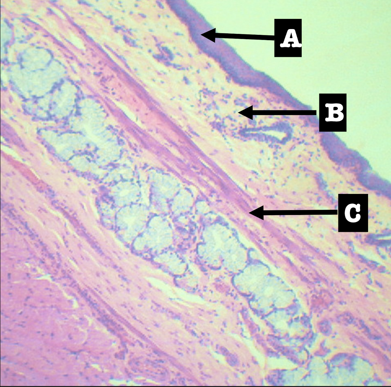 <p>MORPHOLOGY and location of lamina propria of structure</p>