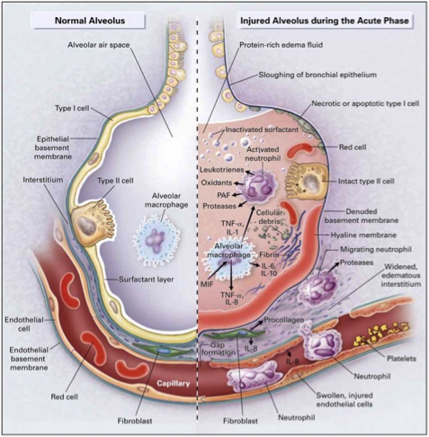 <p>Exudative Phase</p>