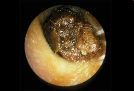 <p>Waxy substance</p>