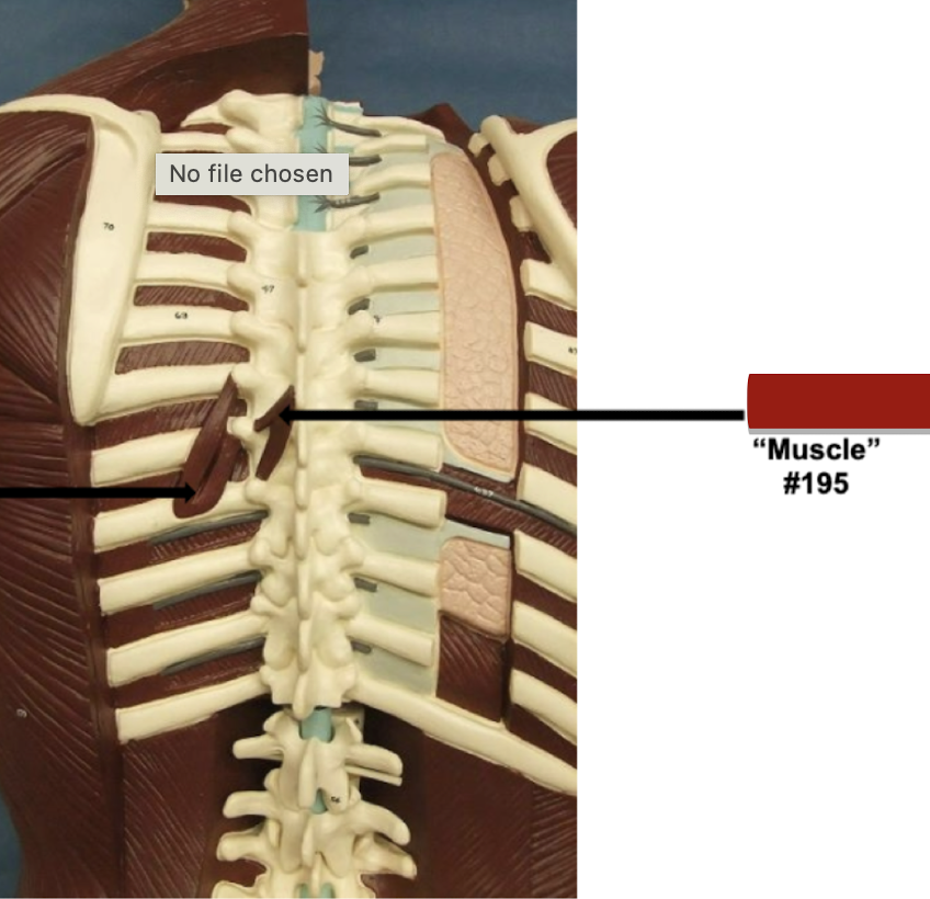 <p>Label muscle #195</p>