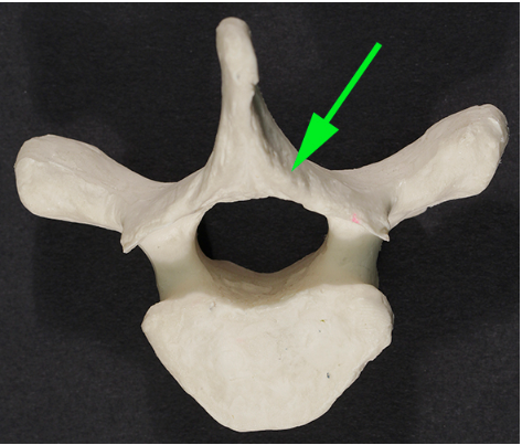 <p>What part of the vertebra is marked by the green arrow?</p>