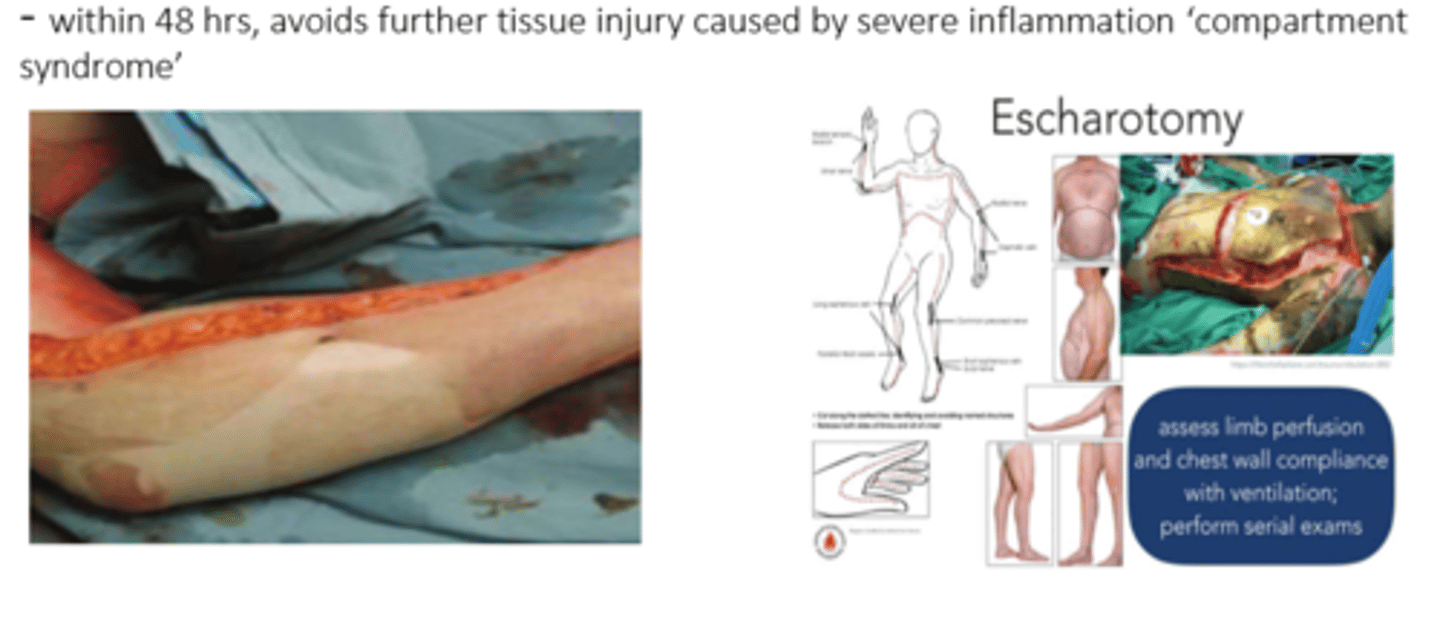 <p>- incision into eschar/necrotic tissue, opening it up to alleviate pressure caused by inflammation</p><p>- helps pt still maintain fx</p><p>- done within 48 hrs of onset, avoids further tissue injury caused by severe inflammation aka 'compartment syndrome' (painful condition d/t high pressure)</p>