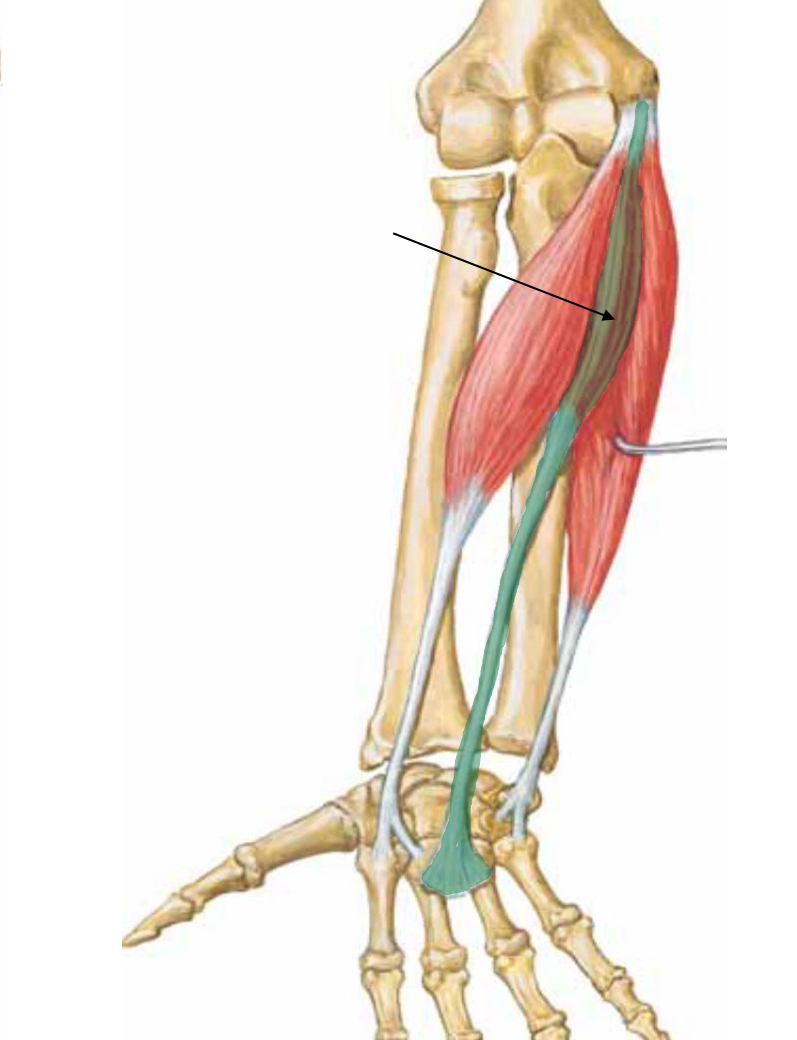 <p>What muscle is indicated?</p>