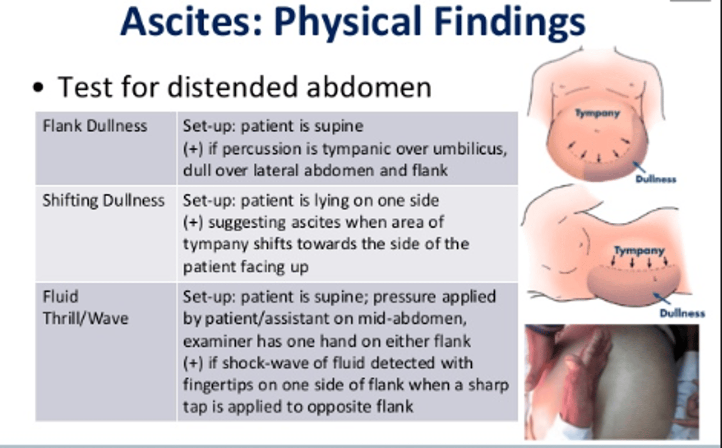 <p>D</p><p>If ascites (fluid in the abdomen) is present, then the examiner will feel a fluid wave when assessing the abdomen. A fluid wave is not present with splenomegaly, a distended bladder, or constipation.</p>