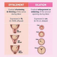 <p>What is the difference between Effacement & dialiation?</p>