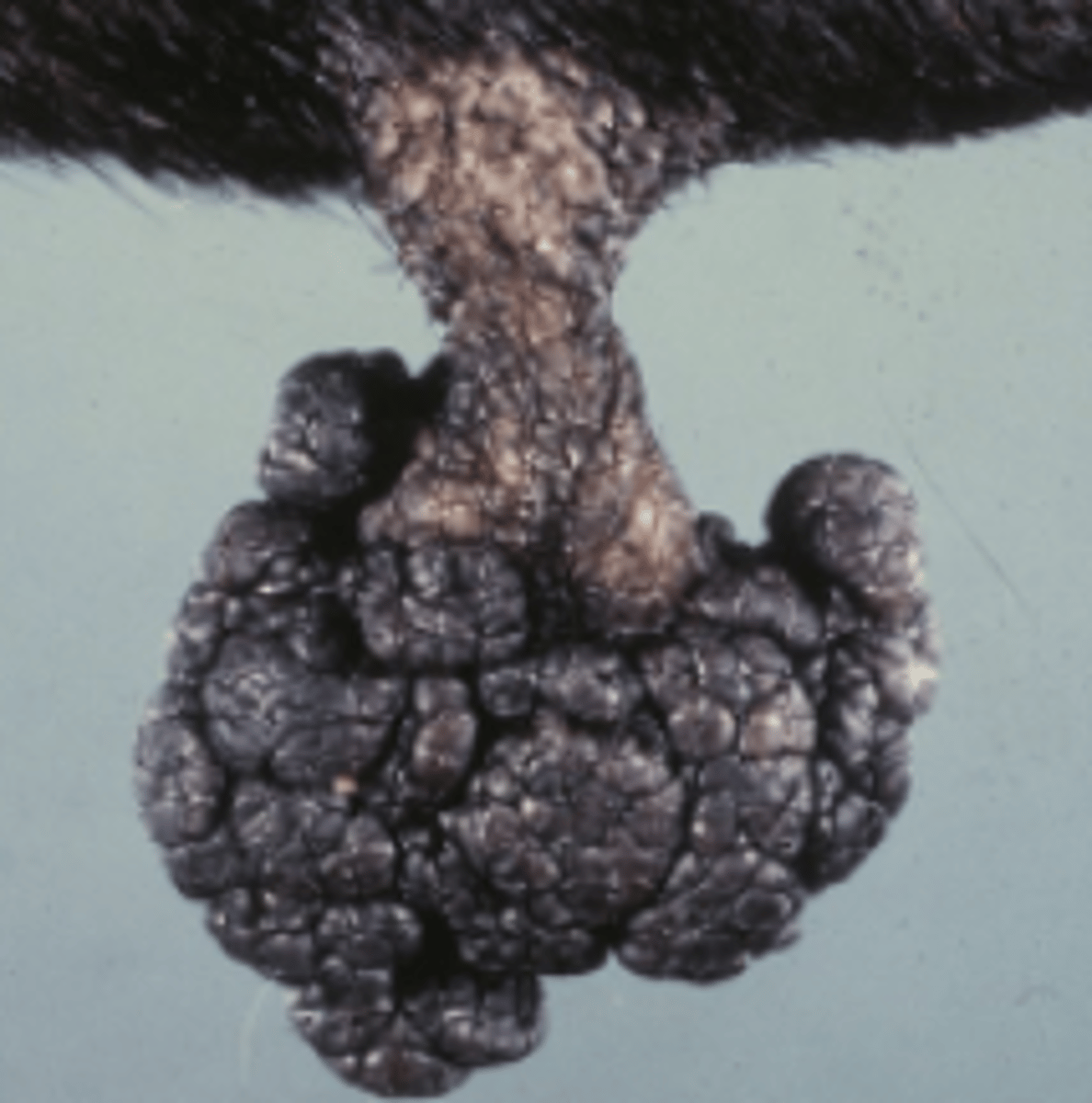 <p>How would you describe this lesion based on the shape?</p>