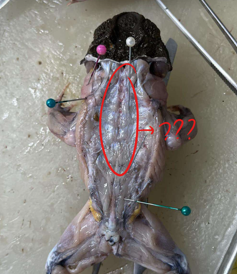 <p>long muscle running close and along the vertebral column</p>