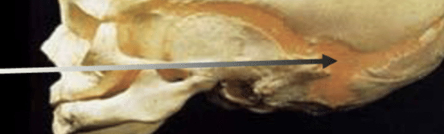 <p>posterolateral fontanel</p>