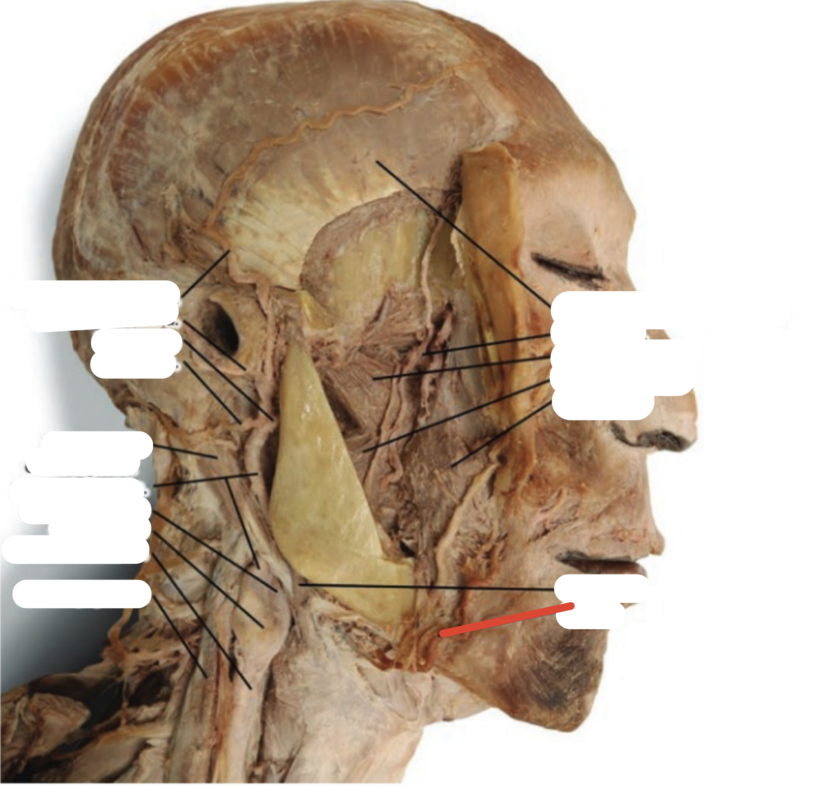Identify the structure (red line)