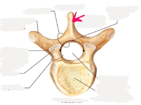 <p>name this bone or bone marking</p>