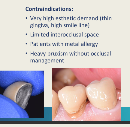 <ul><li><p>very high aesthetics demands</p></li><li><p>limited interocclusal space</p></li><li><p>metal allergy</p></li><li><p>heavy bruxism without occlusal management</p></li></ul><p>Ceramic covering metal - metal on the inside - reduced translucency overall but still more aesthetic</p><p>thinner ceramic on the cervical area - high smile line - metal starts to show through more</p>