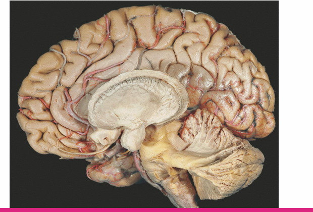 <p>Identify the caudate, putamen, white matter tracts and amygdala </p>