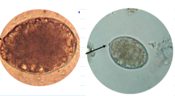 <ul><li><p><span>Abopercular knob</span></p></li><li><p><span>Indistinct, non-shouldered operculum</span></p></li><li><p><span>Chicken shaped egg</span></p><ul><li><p><span>55-75 um in length</span></p></li></ul></li></ul><p></p>