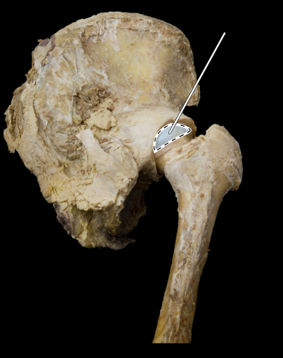 <p>Hip joint</p>