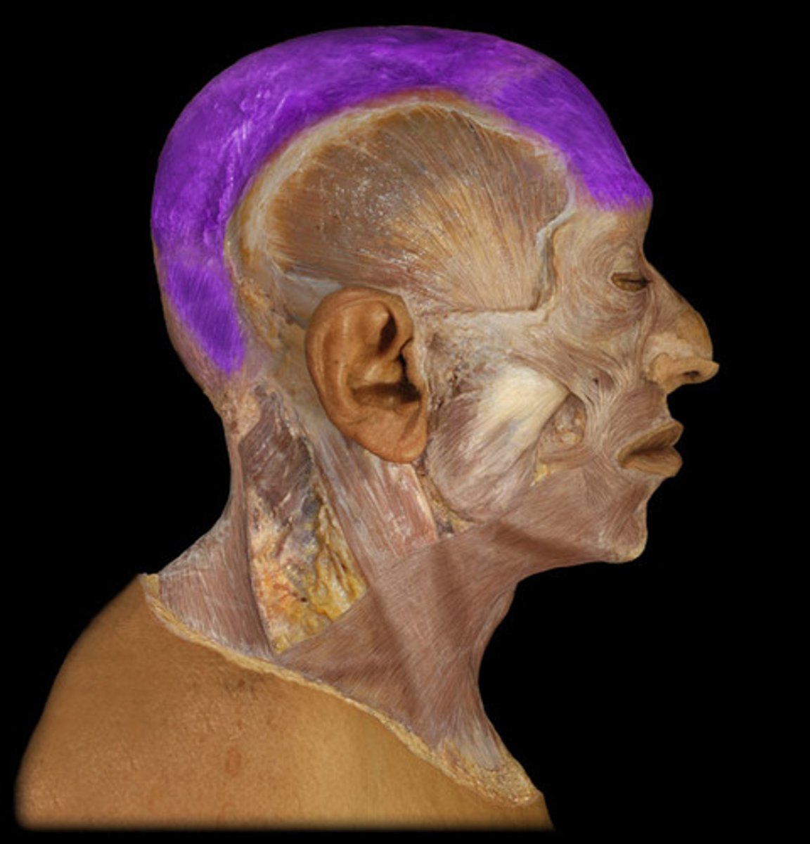 <p>action of occipitofrontalis</p>