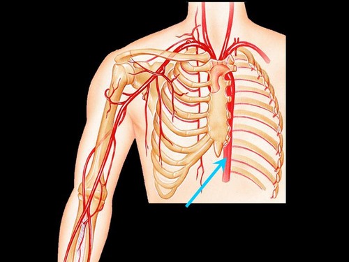 <p>Ignore the arrow. The paired artery that originates on the subclavian artery and descends down the posterior side of the anterior rib cage on either side of the sternum</p>