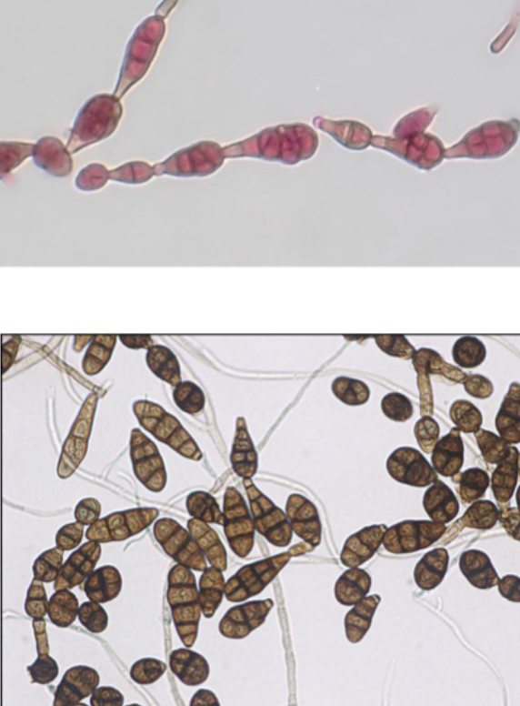 <p>Alternaria sp.</p>