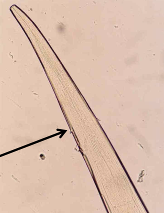 <p><span><span>Which parasites are shown in this picture, and which morphological feature supports this conclusion?</span></span></p>