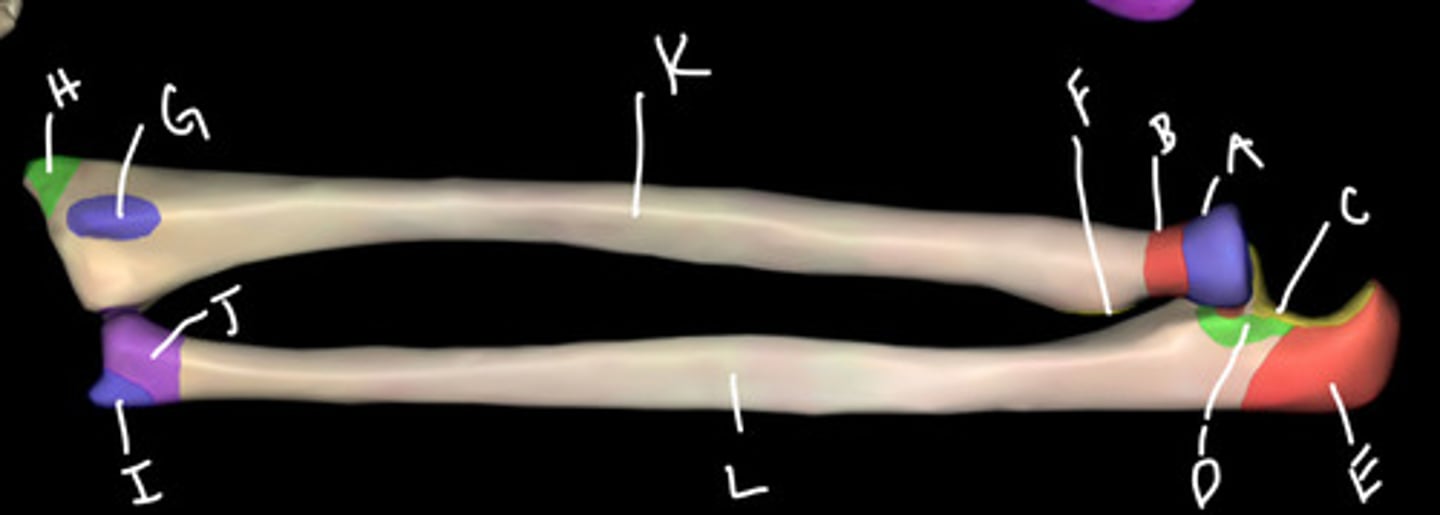 <p>E</p>