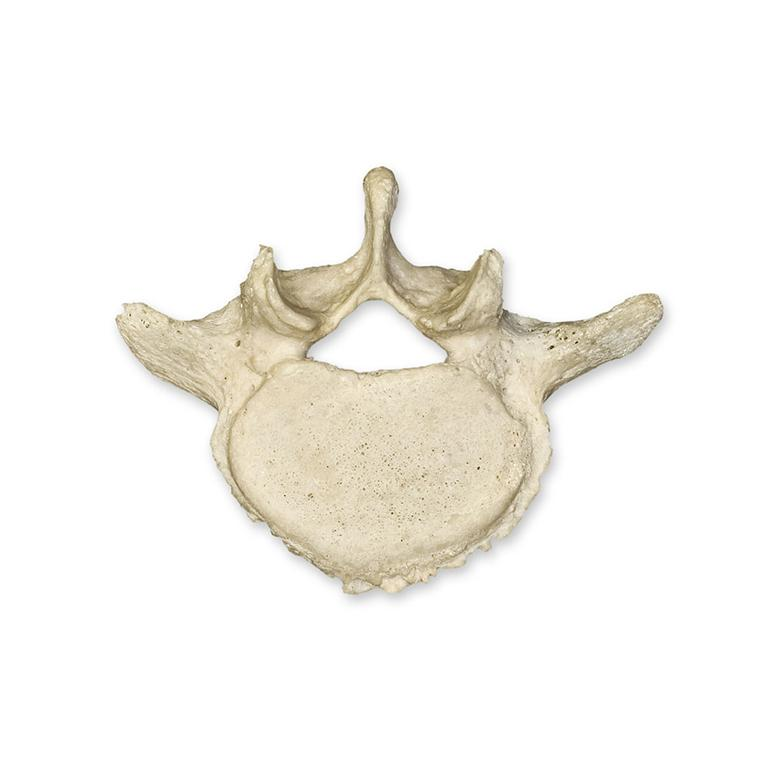 <p>What kind of vertebrae is this? </p>