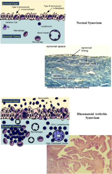 <p><span>How does the appearance of the histology relate to the function of the joint in the clinical disease?</span></p>