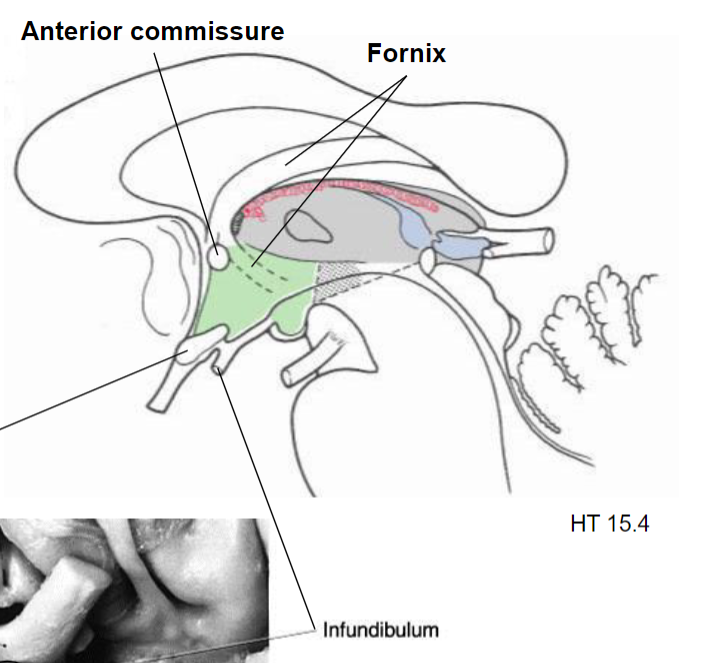 <p>Optic chiasm</p>