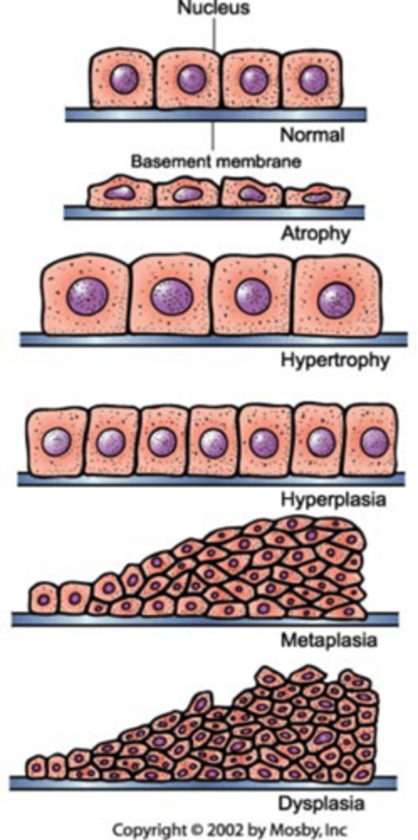 <p>- Mechanism used to prevent cellular and tissue harm due to stressors</p><p>- Change in size: Atrophy and hypertrophy</p><p>- Change in number: Hyperplasia</p><p>- Change in form: Metaplasia and dysplasia</p><p>- Responses also include intracellular accumulations and storage of products in abnormal amounts</p><p>- Genes can be operating genes needed for normal cell function or genes that determine specialized function (differentiation)</p><p>- Usually the differentiation genes are altered- Normal adaptive responses occur in response to need and an appropriate stimulus</p>