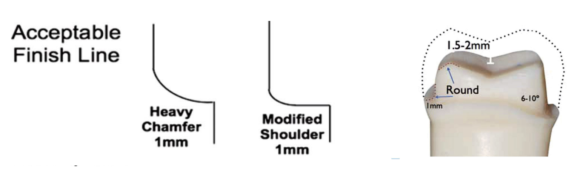 <ul><li><p>heavy chamfer 1 mm </p></li><li><p>modified shoulder 1 mm </p></li></ul><p></p>
