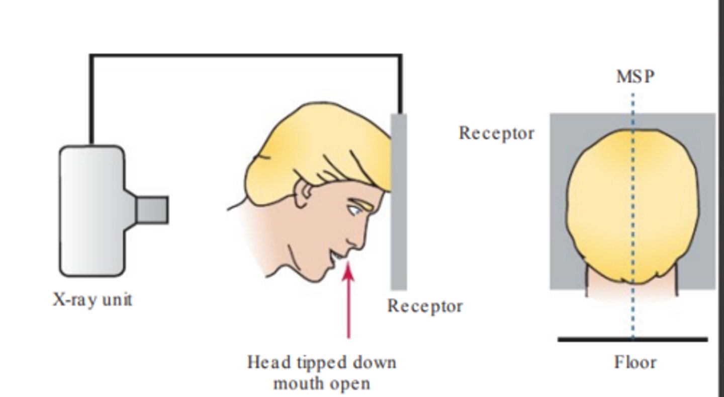 <p>- head tipped down</p><p>- mouth open</p><p>- top of forehead touches receptor</p>